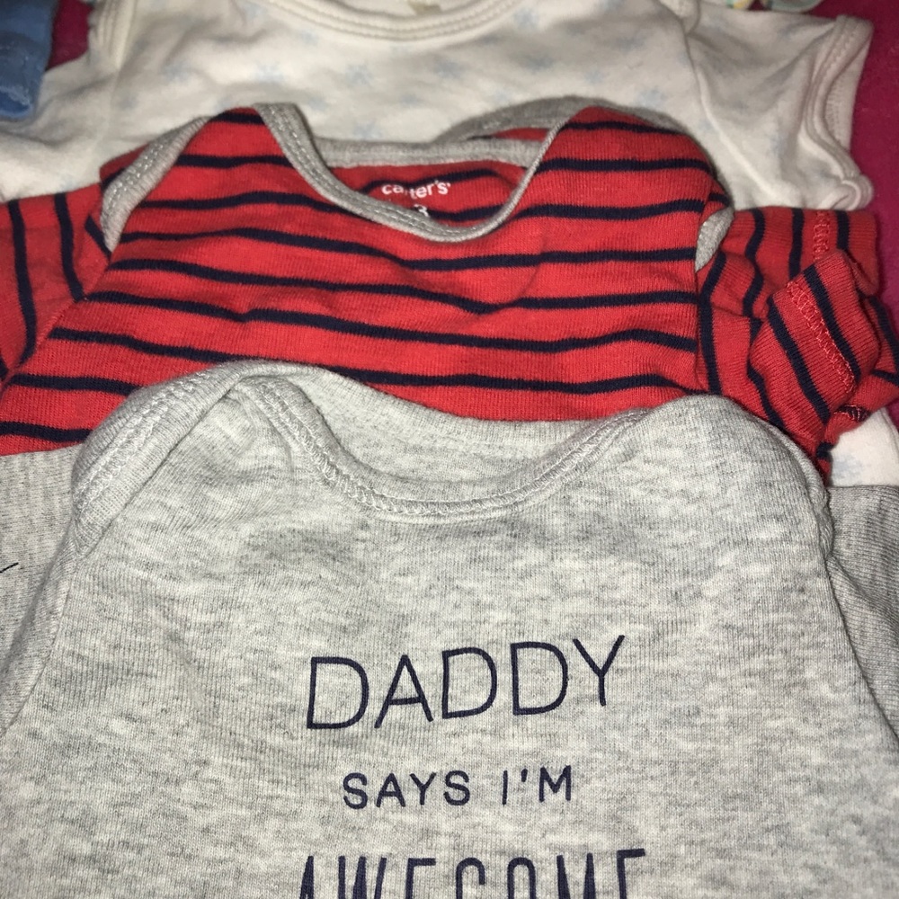 5 onesies, baseball PJs, dalmatian shirt